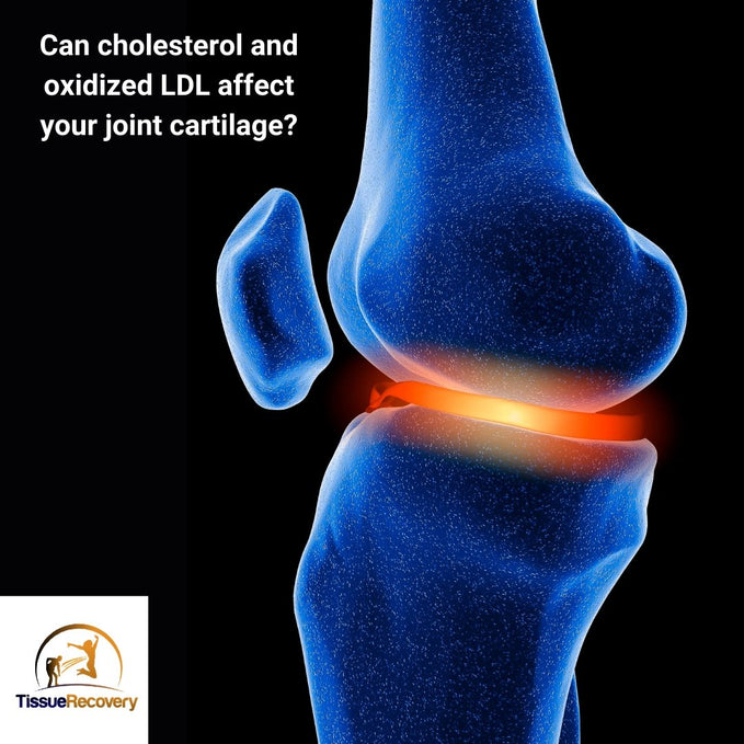 Can cholesterol and oxidized LDL affect your joint cartilage?