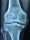 How to protect the cartilage of your joints from oxidative stress and degeneration.