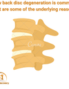 Low back disc degeneration is common, what are some of the underlying reasons?