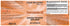products/curcumin-ex-tissuerecovery-2.jpg