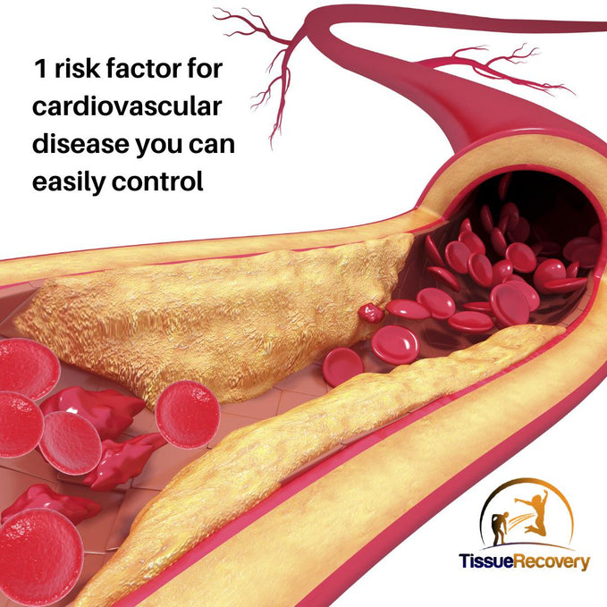 1 risk factor for cardiovascular disease you can easily control.