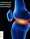 Can cholesterol and oxidized LDL affect your joint cartilage?