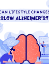 Can Lifestyle Changes Slow Alzheimer's? Insights from a New Study