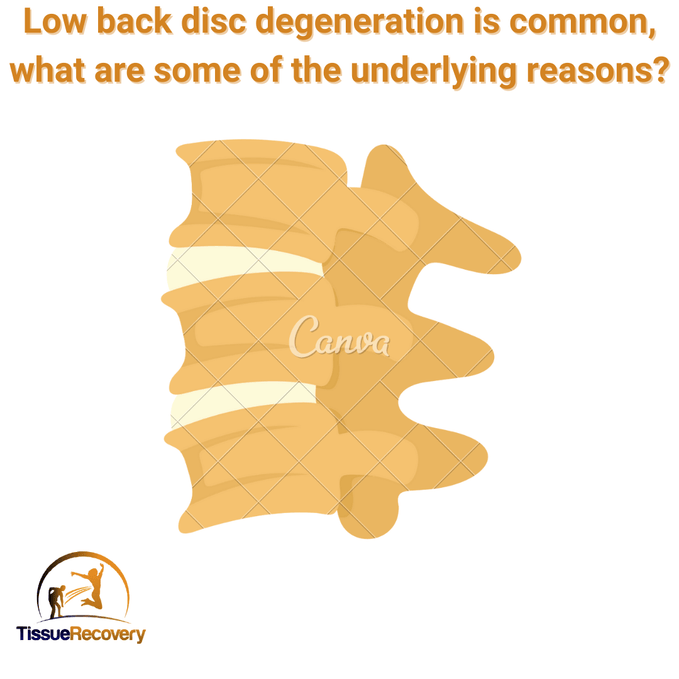 Low back disc degeneration is common, what are some of the underlying reasons?