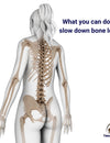 What you can do to slow down bone loss.