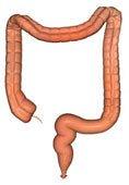 Certain types of fat are contributing to ulcerative colitis. | tissuerecovery