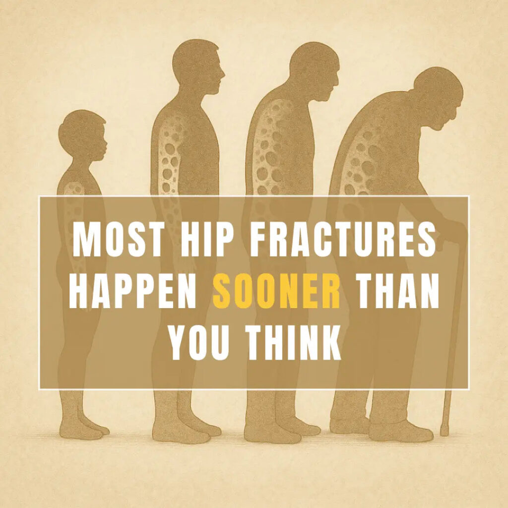 Most Hip Fractures Happen Sooner Than You Think