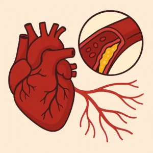 ldl cholesterol heart artery plaque illustration